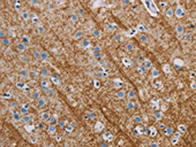 ABL1 Antibody