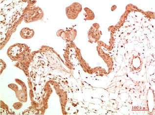 ABL1 Antibody