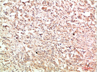 ABL1 Antibody