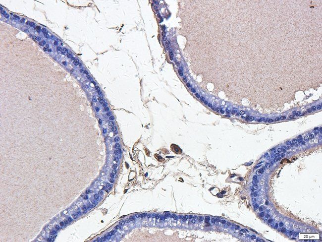 ABL2 antibody