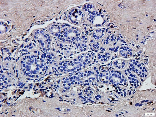 ABL2 antibody