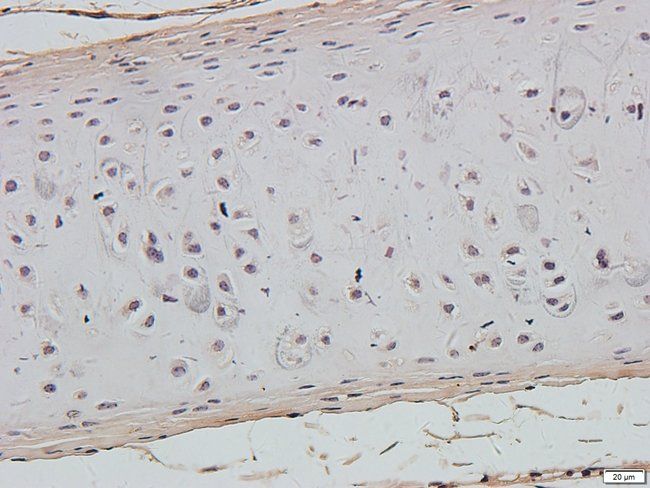 ABL2 antibody