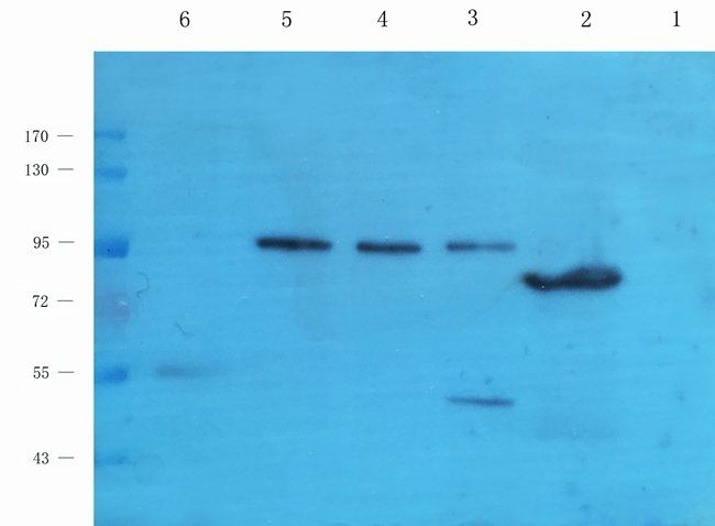 ABL2 antibody