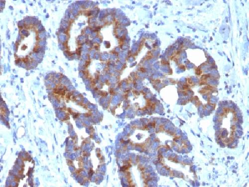 ABO Antibody