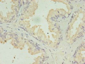ACAA1 Antibody