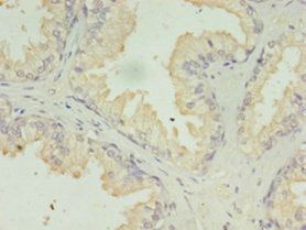 ACAA1 antibody