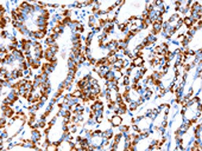 ACAA2 antibody