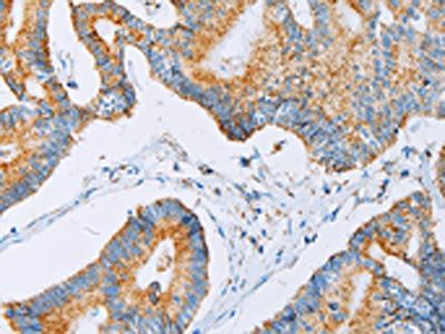ACAA2 Antibody