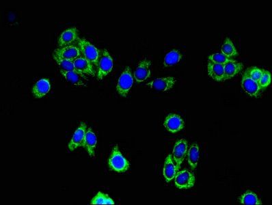 ACAA2 antibody