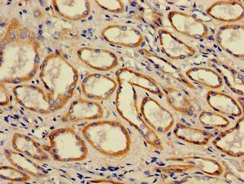 ACAA2 Antibody
