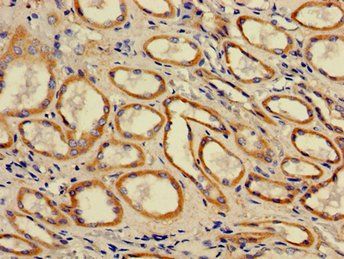 ACAA2 antibody