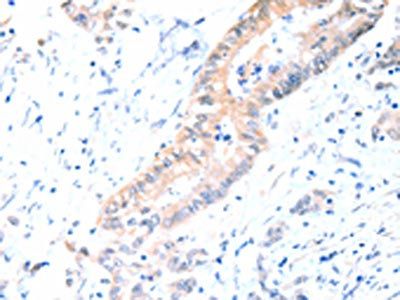 ACAD10 Antibody