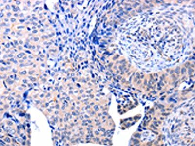 ACAD10 Antibody