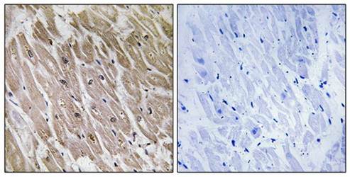 ACAD10 Antibody