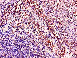 ACAD8 Antibody