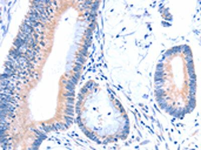 ACAD8 Antibody