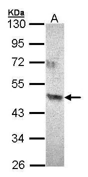 interleukin 22 receptor subunit alpha 2 Antibody