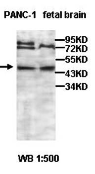 ACAD8 Rabbit Polyclonal Antibody