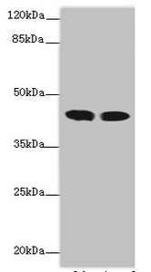 ACADL antibody