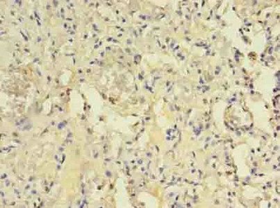 ACAP1 Antibody