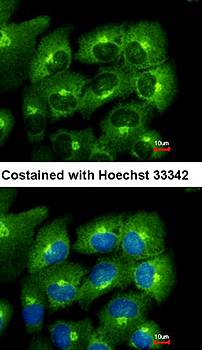 ACAP1 antibody