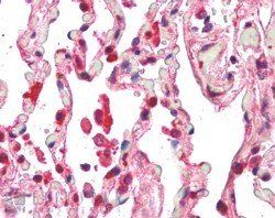 Goat anti-CENTB2 / ACAP2 Antibody