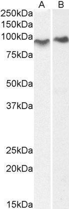 ACAP2 antibody