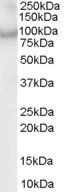 Goat anti-CENTB2 / ACAP2 Antibody