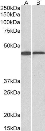 ACAT1 (aa253-266) Antibody
