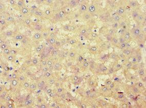ACAT1 Antibody