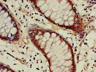 ACAT1 Antibody