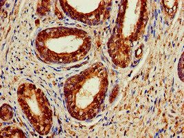 ACAT1 Antibody