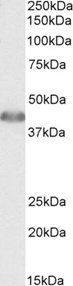Goat anti-ACAT1 (aa257-269) Antibody