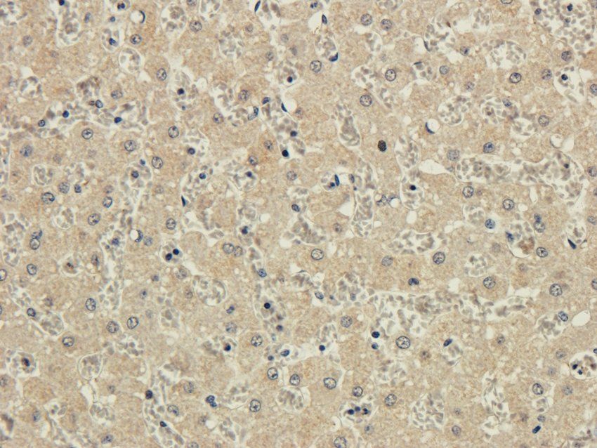 ACAT2 antibody