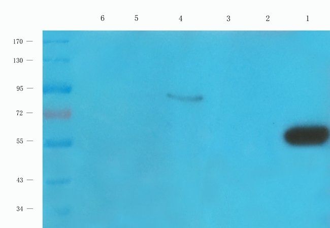 ACAT2 antibody