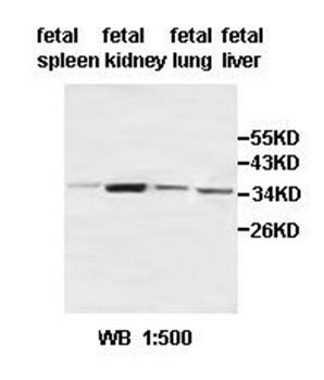 ACBD4 antibody