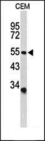 ACCN2 antibody