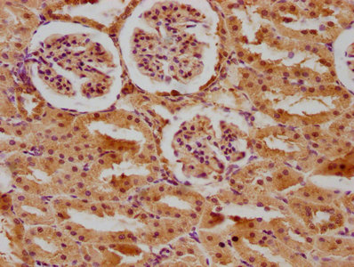 Ace Antibody
