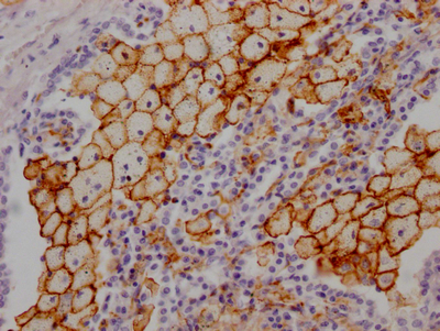 ACE Recombinant Monoclonal Antibody