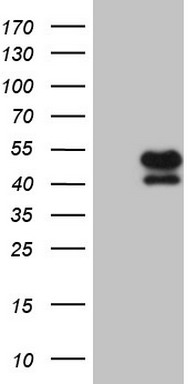 Angiotensin Converting Enzyme 2 Antibody