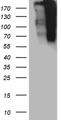 Angiotensin Converting Enzyme 2 Antibody