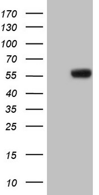 Angiotensin Converting Enzyme 2 Antibody