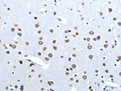 ACE2 Antibody