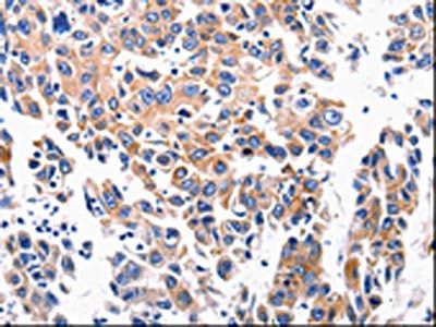 ACE2 Antibody