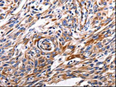 ACE2 Antibody