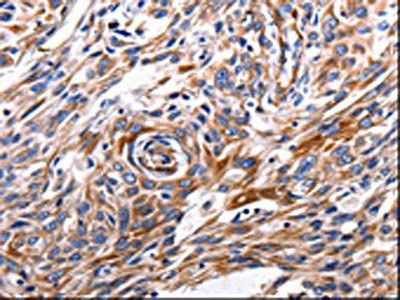 ACE2 antibody