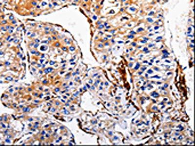 ACE2 Antibody