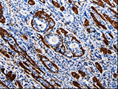 ACE2 Antibody