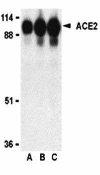 ACE2 Antibody