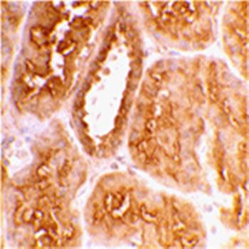 ACE2 Antibody